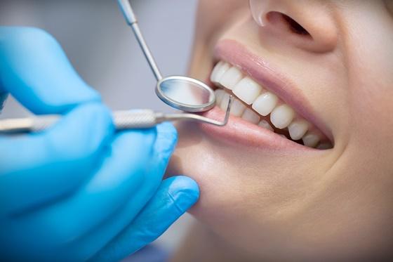Kirjanpitäjän vinkki: säännöllinen hammashoito on veroton henkilöstöetu